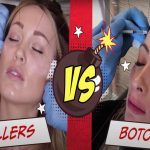 Fillers vs Botox