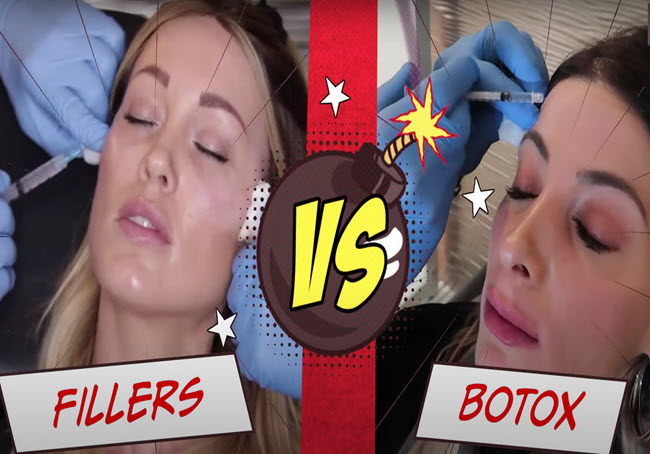 Fillers vs Botox